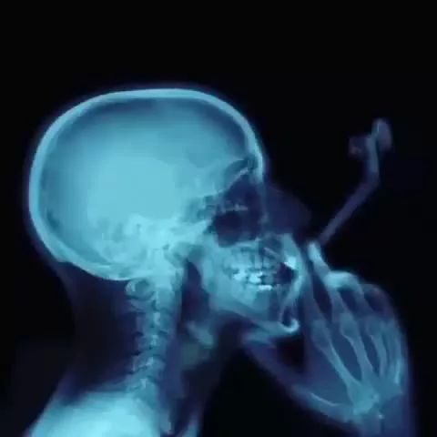 یک فرد در حال سیگار کشیدن در اسکن MRI