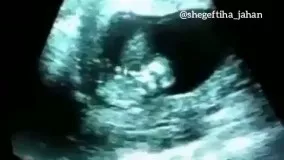 بازی کردن جنین داخل شکم مادر 