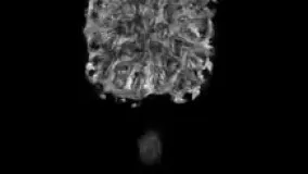 تصویر آناناس در دستگاه MRI 240