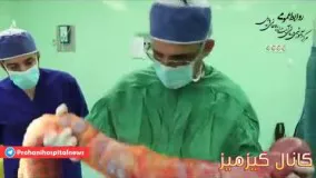 ????فیلم خارج کردن روده بزرگ 5 کیلویی از شکم خانم  52ساله بابلسری در بیمارستان روحانی بابل همراه با توضیحات پزشک جراح  