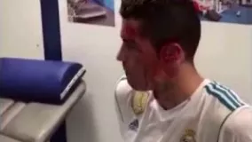 فیلم/ ویدئویی که رونالدو از زخم صورتش منتشر کرد