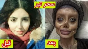 سحر تبر دختر مشهور ایرانی با بیش از پنجاه عمل جراحی 