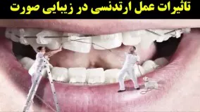 کلیپ های عجیب و جالب-ارتودنسی عمل زیبایی دندان کریستیانو رونالدو  