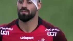 شکستن سر بازیکن با سنگ تماشاگر در بازی دربی-محمد حسین کنعانی زادگان
