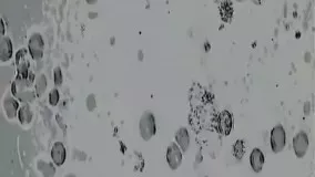 تصاویر مشاهده شده از ویروس کرونا توسط میکروسکوپ