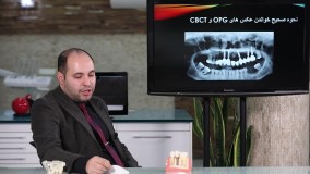 آموزش ایمپلنت دندانی توسط دکتر میرمحمدی
