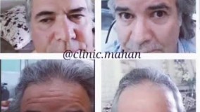 خدمات تخصصی پوست و مو در تهران