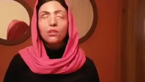 پیام معصومه عطایی از قربانیان اسید پاشی به مناسبت روز جهانی زن