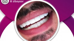 خدمات دندانپزشکی در مشهد