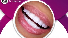 هزینه ارتودنسی دندان در مشهد